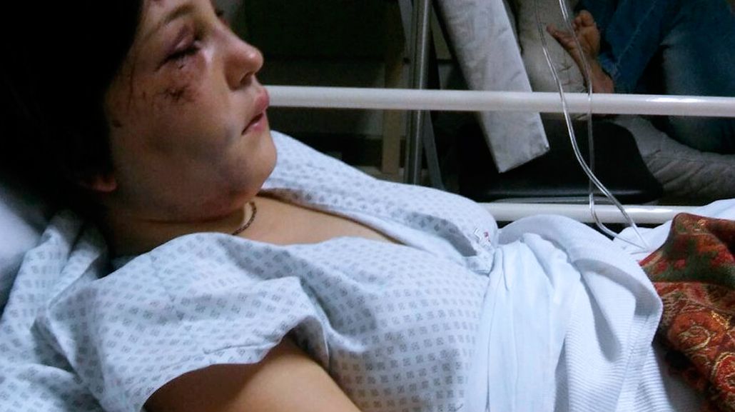 Tiene golpes en la cara y en la espalda. Todavia no puede escuchar de un oÃdo<br>
