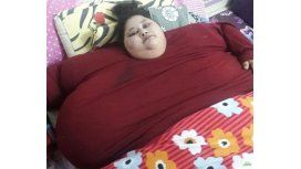 Tiene 36 años y es la mujer más obesa del mundo: Necesita una operación urgente Tiene 36 años y es la mujer más obesa del mundo: Necesita una operación urgente