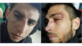 Así terminaron dos jugadores de Villa Mitre de Bahía Blanca Así terminaron dos jugadores de Villa Mitre de Bahía Blanca