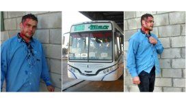 Así quedó el colectivero de la línea 620 Así quedó el colectivero de la línea 620