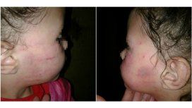 Niña golpeada por padrastro en La Plata Niña golpeada por padrastro en La Plata