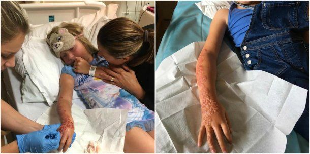 Madison Gulliver y una marca de por vida por el tatuaje de henna<br>