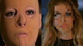 La increíble transformación de la mujer a la que le quemaron 60% del cuerpo La increíble transformación de la mujer a la que le quemaron 60% del cuerpo