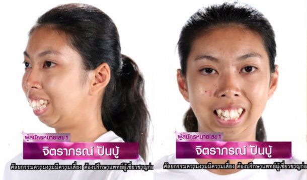 El defecto físico de la joven saltaba a la vista