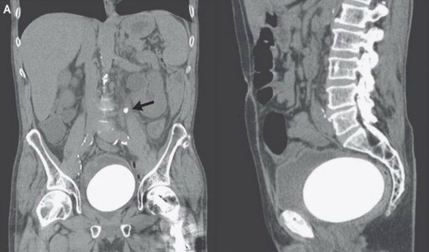 Las radiografías mostraron el estado apremiante del paciente