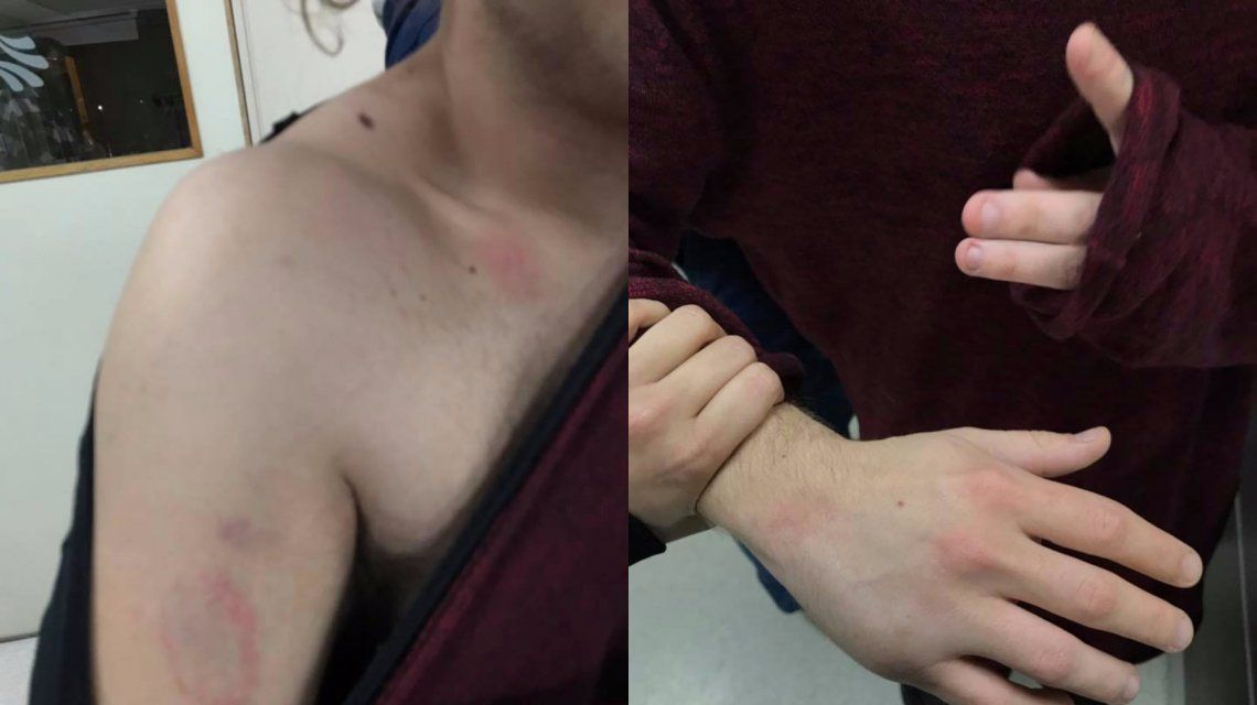 Patovicas golpearon a una chica y su novio a la salida de un boliche de la Costanera