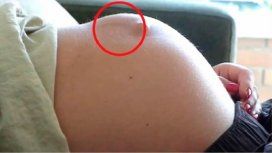 Increíble: un bebé le perforó el útero a su mamá de una patada Increíble: un bebé le perforó el útero a su mamá de una patada