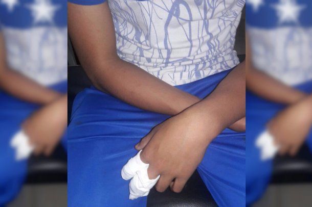 Lucas Rojas recibió machetazos en la cabeza y en los dedos