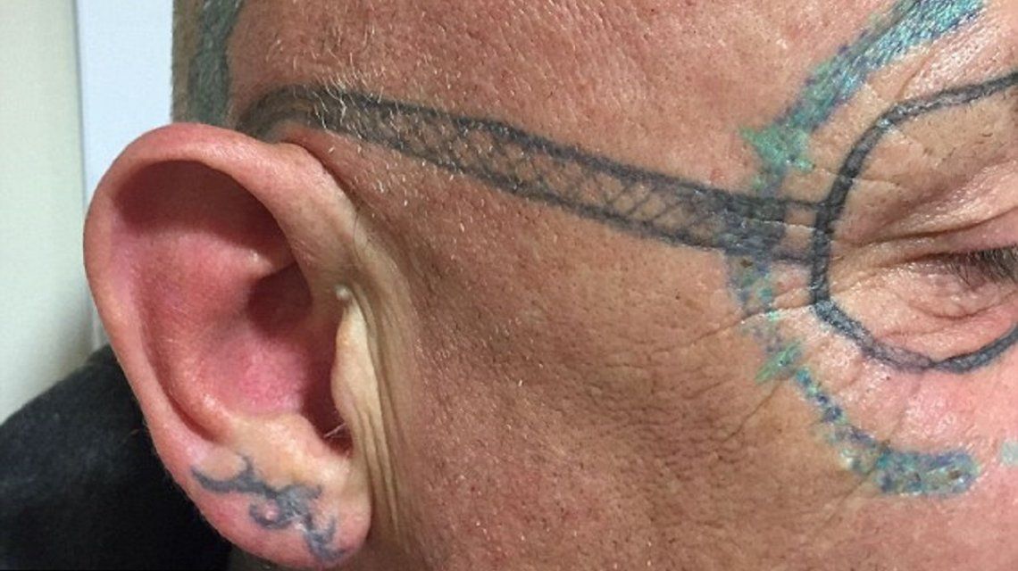 ¿La peor resaca del mundo?: se fue de fiesta y despertó con un horrendo tatuaje en la cara
