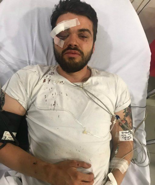 La Comunidad Homosexual Argentina (CHA) indicó que los ataques homofóbicos crecieron un 20 por ciento.