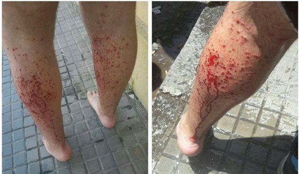 Así resultaron heridos los dos adolescentes