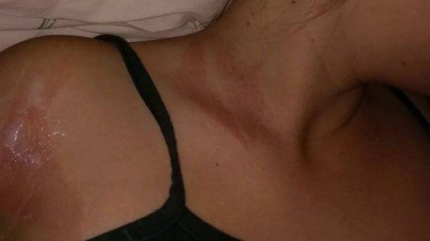 Tuvo daños en el cuello y en el brazo derecho<br>