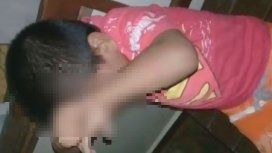 El niño agredido se protegía como podía de los golpes de su madre El niño agredido se protegía como podía de los golpes de su madre