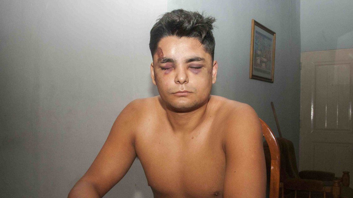 Claudio Torres Brizuela fue salvajemente golpeado por la policía