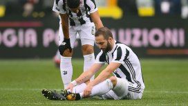 Gonzalo Higuaín se fue lesionado en el derby de Turín. Gonzalo Higuaín se fue lesionado en el derby de Turín.