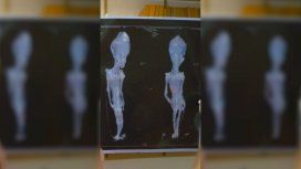 Al final no era un alien sino una bebé que murió al poco tiempo de nacer Al final no era un alien sino una bebé que murió al poco tiempo de nacer