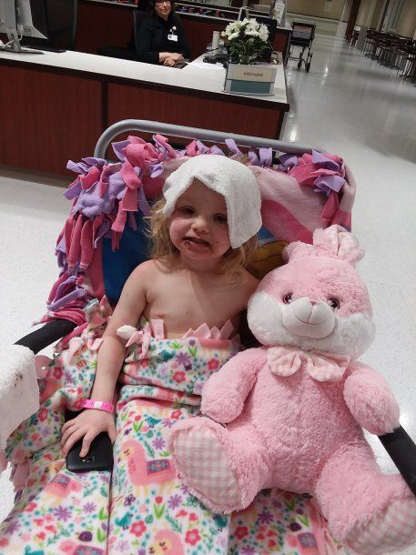 Una nena sufrió una reacción alérgica por el maquillaje