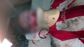 Un futbolista noqueó a otro Un futbolista noqueó a otro