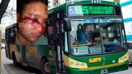 Otro ataque a un colectivero: desfiguraron a un chofer de la línea 85 en Quilmes Otro ataque a un colectivero: desfiguraron a un chofer de la línea 85 en Quilmes