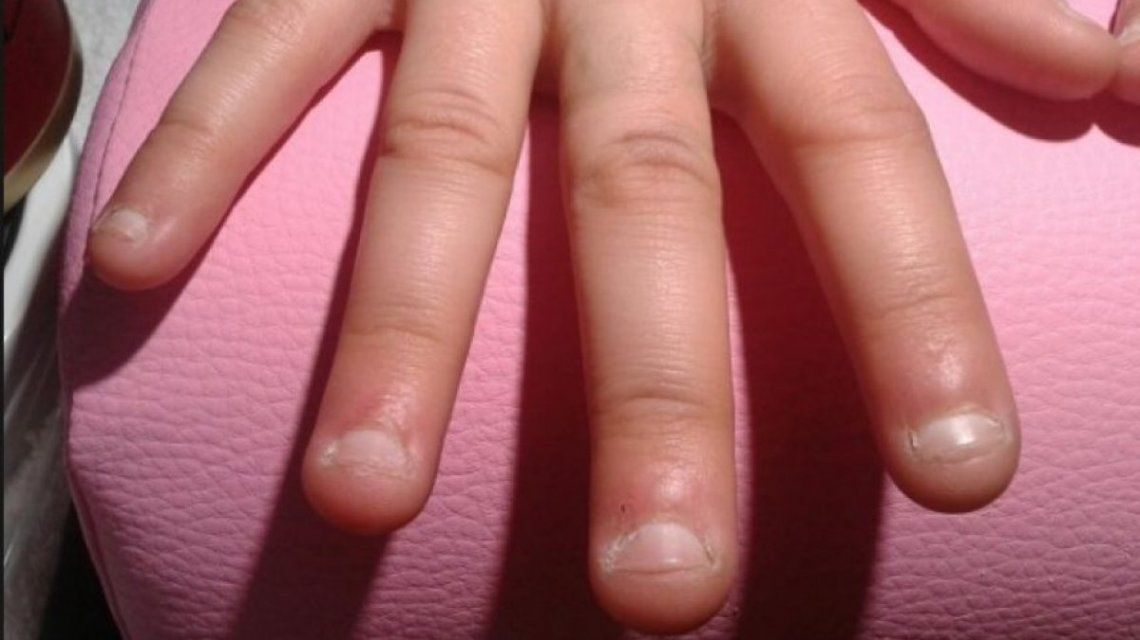 que dicen tus uñas sobre tu salud