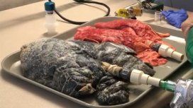 Video: Así respiran los pulmones de un fumador Video: Así respiran los pulmones de un fumador