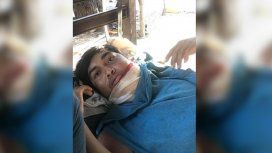 La lucha de Avelino: tiene cáncer de mandíbula y pelea por su vida en el monte salteño La lucha de Avelino: tiene cáncer de mandíbula y pelea por su vida en el monte salteño
