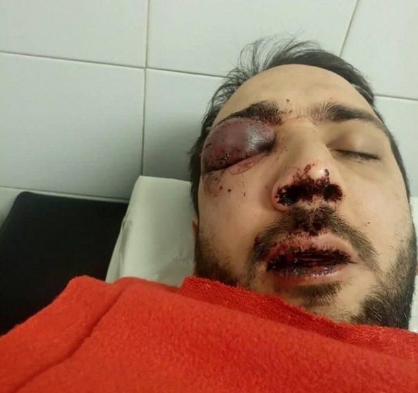Patovicas lo desfiguraron y podría perder un ojo.