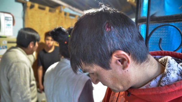 Pelea entre vecinos de Neuquén - Crédito: Omar Novoa/lmneuquen