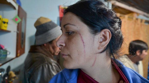 Pelea entre vecinos de Neuquén - Crédito: Omar Novoa/lmneuquen