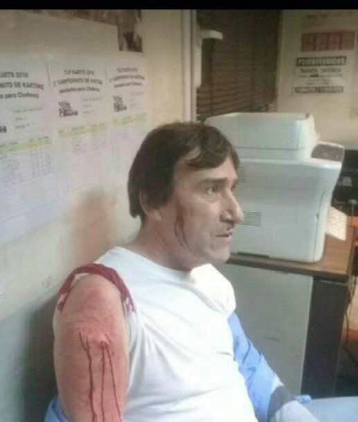 La fuerte imagen del chofer agredido se viralizó en las redes sociales<br>