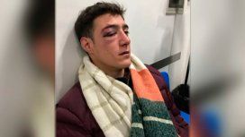 Le dieron un piedrazo en la cara Le dieron un piedrazo en la cara