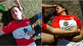 Dos jugadoras de Universitario yacen en el campo de juego tras ser agredidas Dos jugadoras de Universitario yacen en el campo de juego tras ser agredidas
