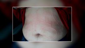 No a las ollas: así fue la brutal tortura a la docente de Moreno No a las ollas: así fue la brutal tortura a la docente de Moreno