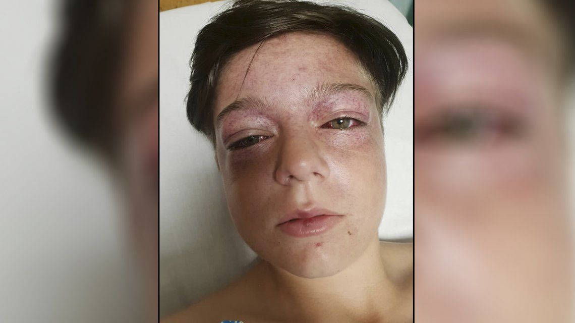 Calesita de la muerte: el nuevo y peligroso desafío viral que alarma Calesita de la muerte: el nuevo y peligroso desafío viral que alarma