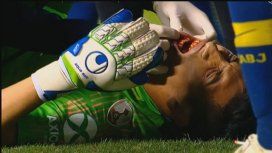 Esteban Andrada sufrió un fuerte golpe en su rostro Esteban Andrada sufrió un fuerte golpe en su rostro