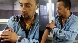 Otro ataque a un colectivero: lo apuñalaron con una trincheta en Moreno Otro ataque a un colectivero: lo apuñalaron con una trincheta en Moreno