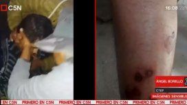 Denuncian que la policía reprimió con balas de plomo una toma de tierra y mató un militante Denuncian que la policía reprimió con balas de plomo una toma de tierra y mató un militante