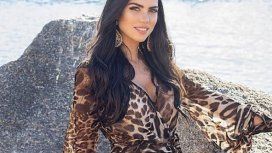 Iba a competir en Miss Universo y le quemaron la cara Iba a competir en Miss Universo y le quemaron la cara