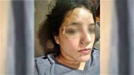 Fue a bailar en Año Nuevo y le dieron una brutal paliza Fue a bailar en Año Nuevo y le dieron una brutal paliza