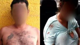Detuvieron a una pareja que golpeó y quemó a sus tres hijos en Florencio Varela Detuvieron a una pareja que golpeó y quemó a sus tres hijos en Florencio Varela
