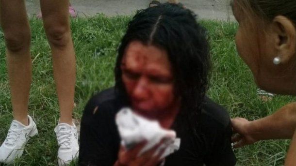 <p>Juan terminó con la cara desfigurada y corre riesgo de perder el ojo izquierdo</p>