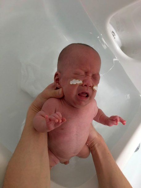 He was born at 24 weeks of gestation and with only 268 grams of weight