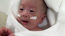 Japón: le dieron el alta al bebé más pequeño del mundo Japón: le dieron el alta al bebé más pequeño del mundo