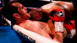 Boxeo: mordisco Boxeo: mordisco