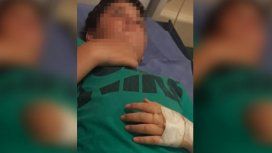 Glew: internaron a un nene de 11 años tras ser agredido en una escuela Glew: internaron a un nene de 11 años tras ser agredido en una escuela