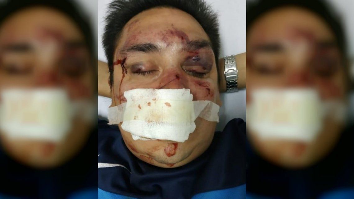 Sebastián Acosta fue brutalmente agredido por barras bravas de Rcaing.