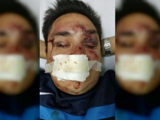Sebastián Acosta fue brutalmente agredido por barras bravas de Rcaing. Sebastián Acosta fue brutalmente agredido por barras bravas de Rcaing.
