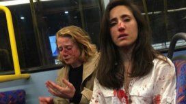 Ataque homofóbico en Londres: liberaron a los detenidos por agredir a una pareja de mujeres Ataque homofóbico en Londres: liberaron a los detenidos por agredir a una pareja de mujeres