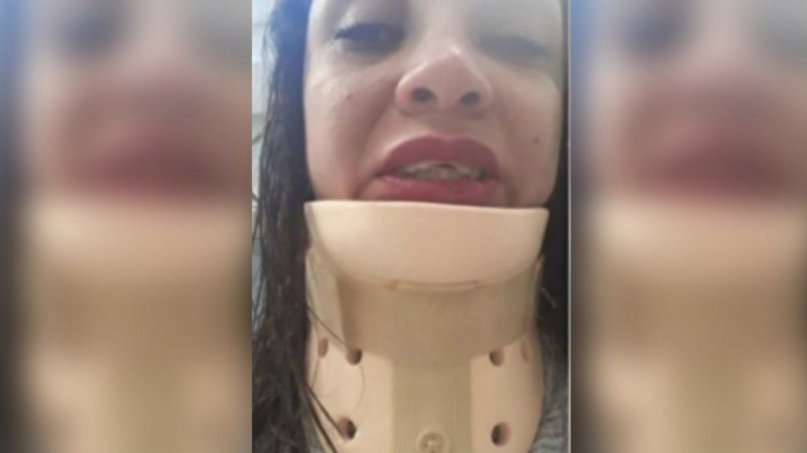 Córdoba: motochorros desfiguraron a una mujer que iba a su despedida de soltera