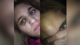 Hizo 17 denuncias contra su ex y sigue siendo amenazada: Te voy a matar como a un perro Hizo 17 denuncias contra su ex y sigue siendo amenazada: Te voy a matar como a un perro